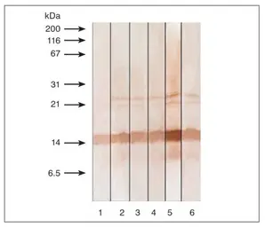 Anti-Calcitonin antibody [13B9] used in Western Blot (WB). GTX11484